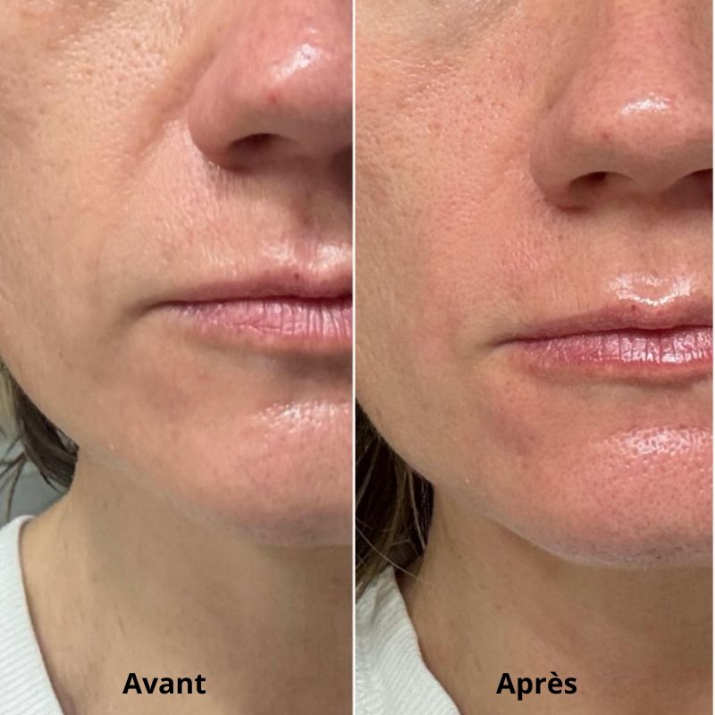 GlowLift™ Stick PDRN & Collagène