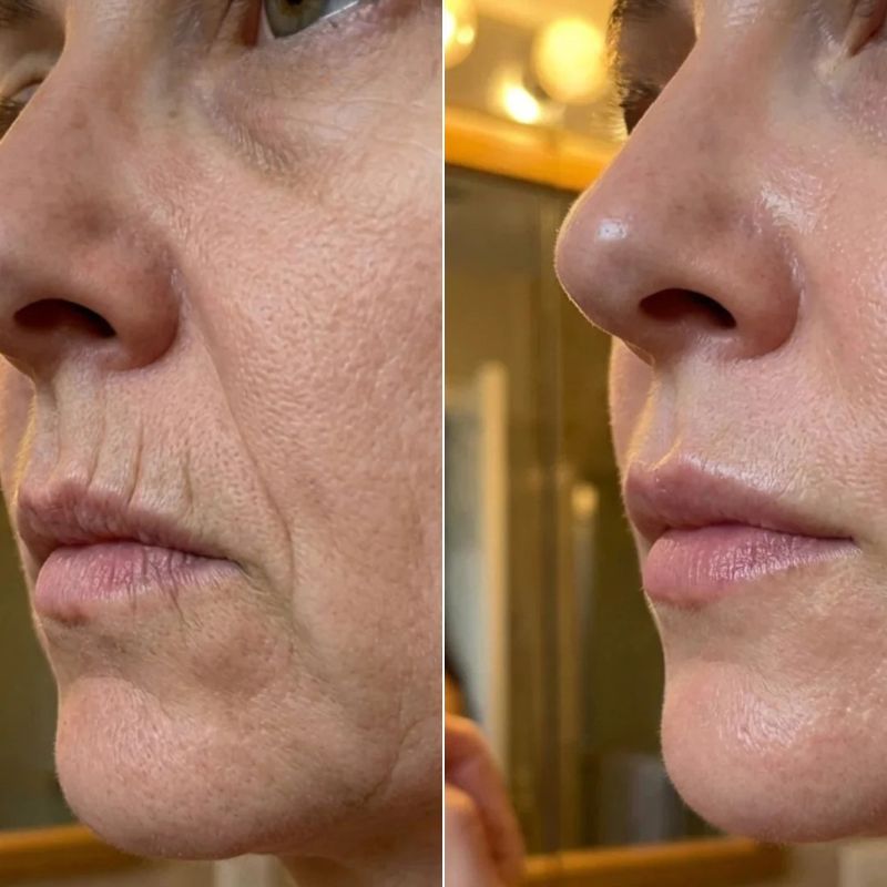 GlowLift™ Stick PDRN & Collagène