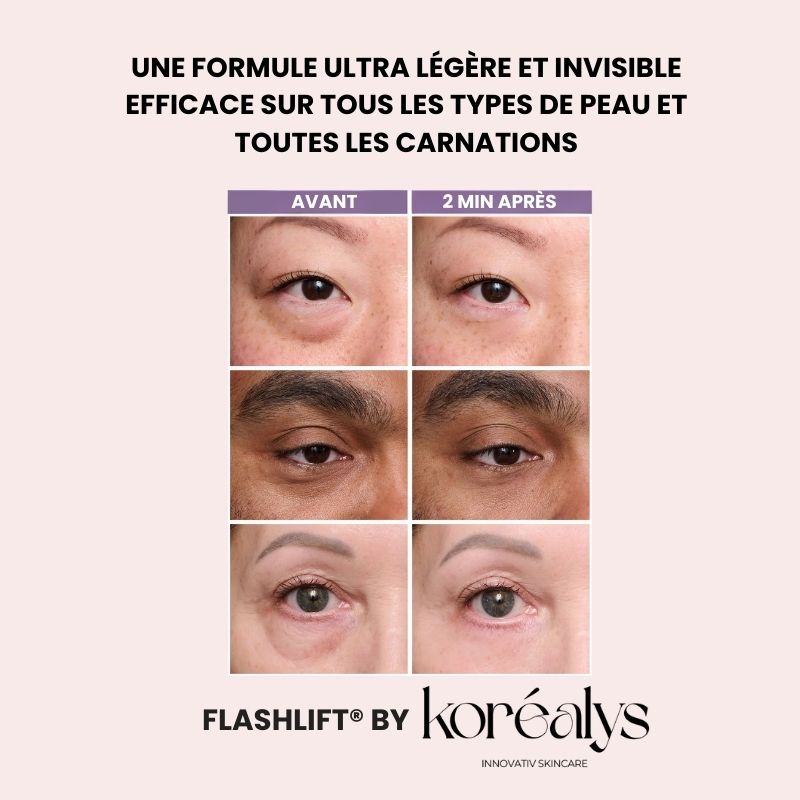 FLASHLift® Contour des yeux effet lift instantané