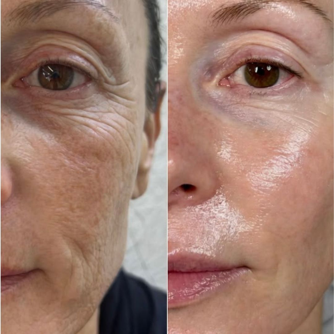 Masque BIO-Collagène Intense - Pack de 4