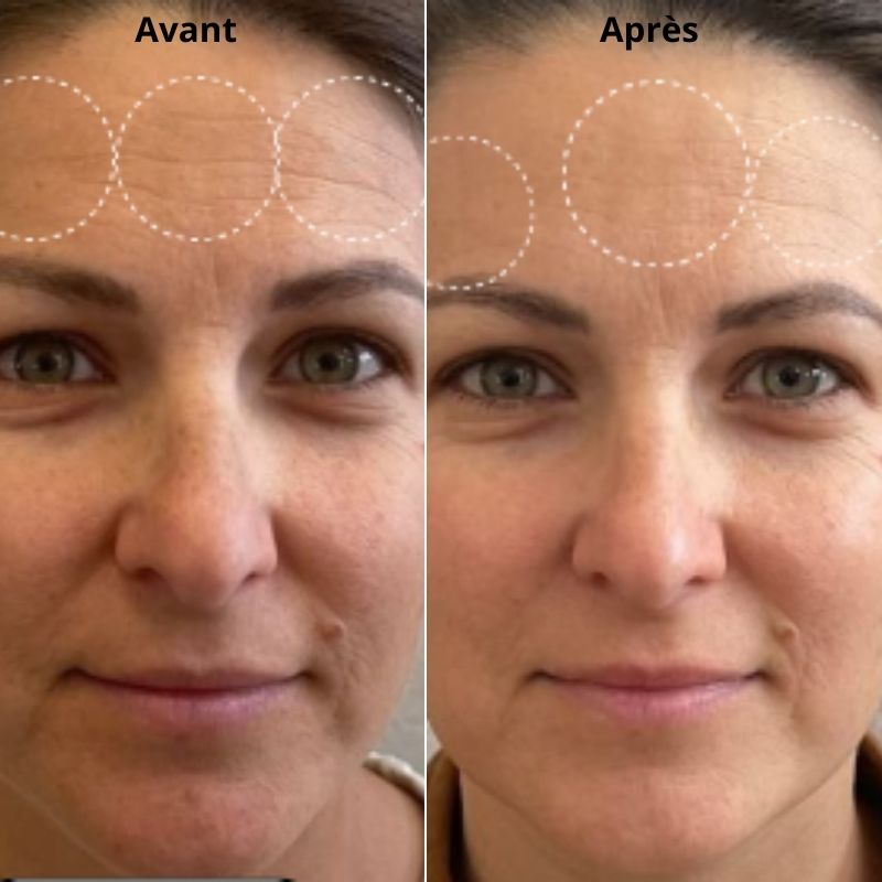 Masque BIO-COLLAGÈNE