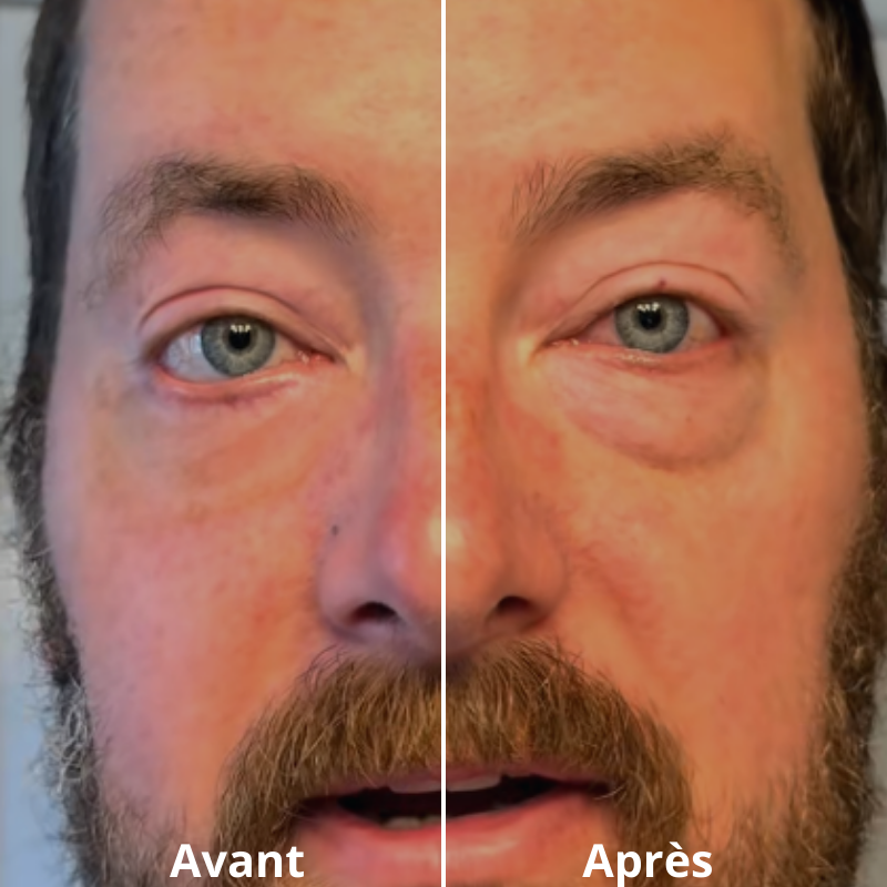 FLASHLift® Contour des yeux effet lift instantané