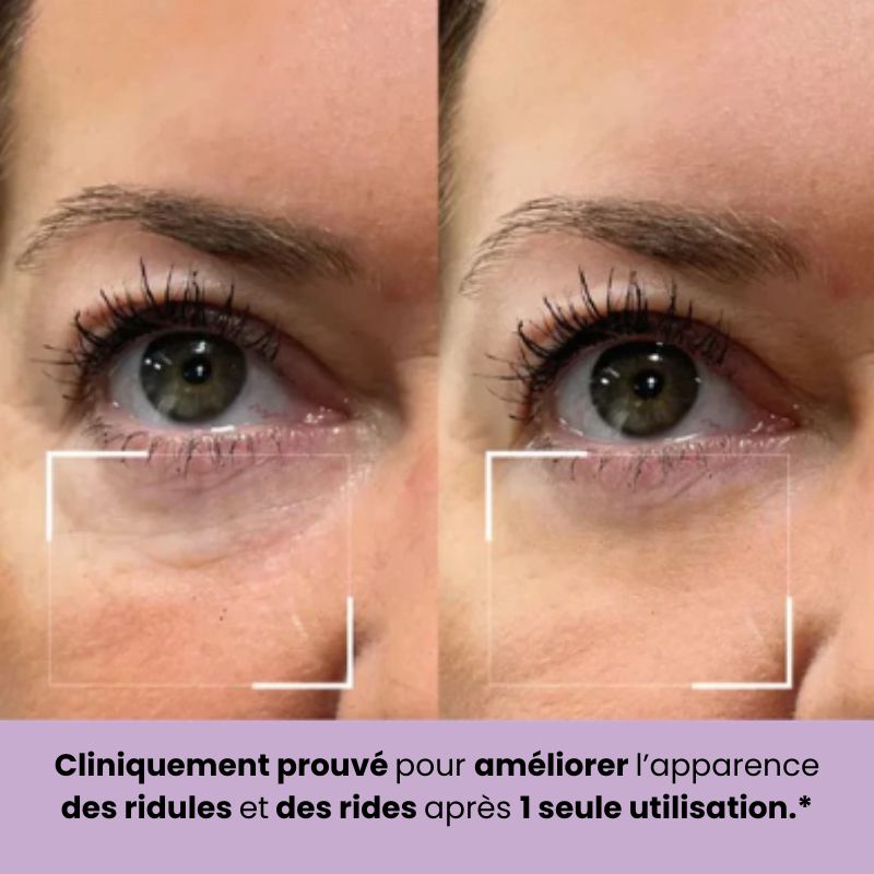 Patchs Hydralift (8 paires)