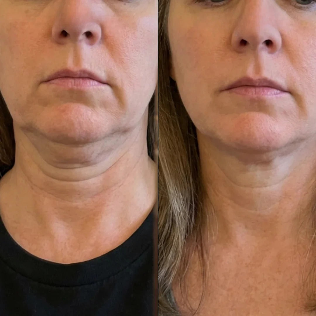 GlowLift™ Stick PDRN & Collagène