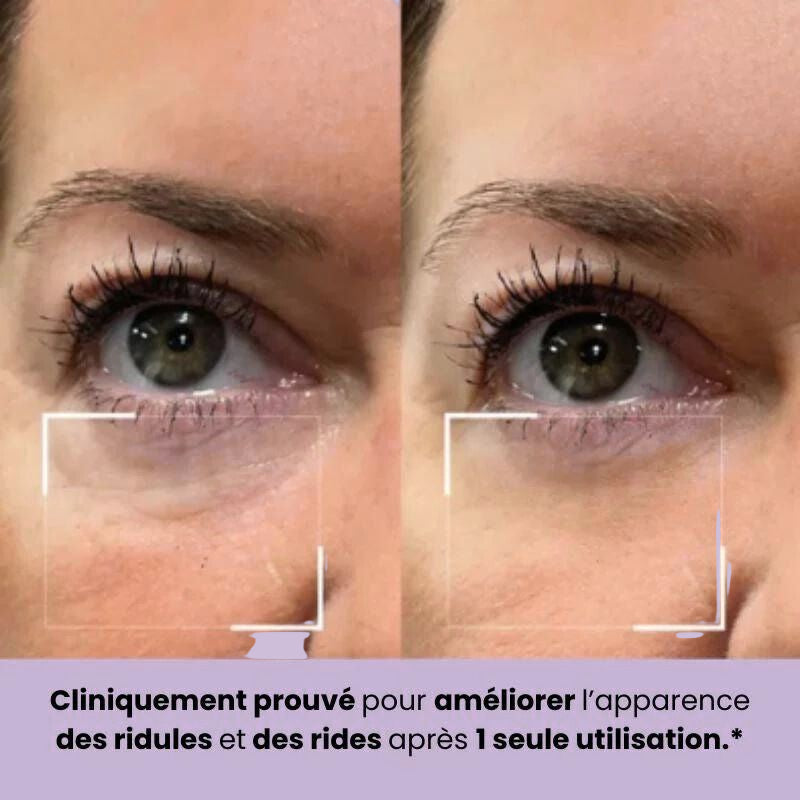 Patchs Hydralift (une paire)